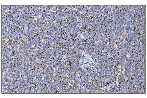 IHC analysis of MERTK using anti-MERTK antibody (ABIN7600623).