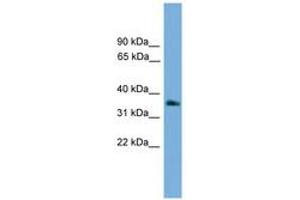 Image no. 1 for anti-Guanine Nucleotide Binding Protein (G Protein), beta Polypeptide 4 (GNB4) (AA 215-264) antibody (ABIN6745161) (GNB4 antibody  (AA 215-264))