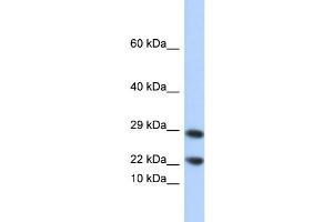 WB Suggested Anti-LCN8 Antibody Titration: 0.