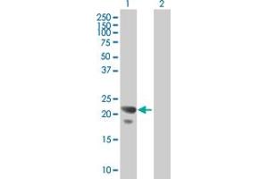 Western Blot analysis of COPS8 expression in transfected 293T cell line by COPS8 MaxPab polyclonal antibody. (COPS8 antibody  (AA 1-209))
