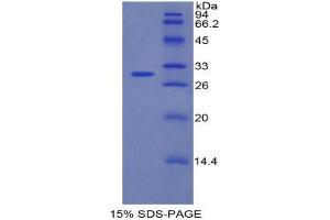 SDS-PAGE (SDS) image for Coagulation Factor V (F5) (AA 463-715) protein (His tag) (ABIN2120829) (Coagulation Factor V Protein (F5) (AA 463-715) (His tag))