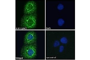 ABIN185361 Immunofluorescence analysis of paraformaldehyde fixed A431 cells, permeabilized with 0. (Lipin 2 antibody  (C-Term))