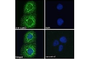 ABIN185361 Immunofluorescence analysis of paraformaldehyde fixed A431 cells, permeabilized with 0. (Lipin 2 antibody  (C-Term))