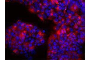 Immunofluorescence (IF) image for anti-Mucin 1 (MUC1) antibody (ABIN2664413) (MUC1 antibody)