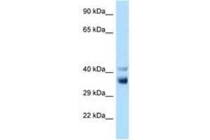 Image no. 1 for anti-NEK7 (NEK7) (C-Term) antibody (ABIN6748080)