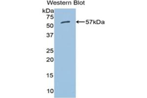 Western blot analysis of the recombinant protein. (ALDH7A1 antibody  (AA 28-539))