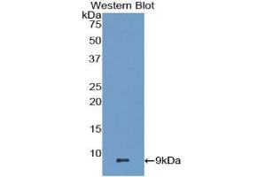 Detection of Recombinant MDC, Mouse using Polyclonal Antibody to Macrophage Derived Chemokine (MDC) (CCL22 antibody  (AA 29-92))