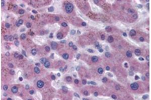 anti-Coagulation Factor VII (F7) antibody