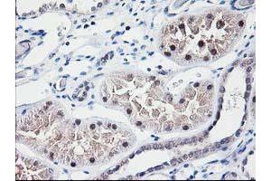 Immunohistochemical staining of paraffin-embedded Human Kidney tissue using anti-NUBPL mouse monoclonal antibody. (NUBPL antibody  (AA 1-250))