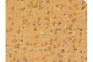 ABIN6262402 and ABIN6268915 at 1/100 staining Rat brain tissue by IHC-P.