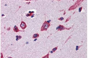 Human Brain, Cortex (formalin-fixed, paraffin-embedded) stained with CBLN4 antibody ABIN462251 followed by biotinylated goat anti-rabbit IgG secondary antibody ABIN481713, alkaline phosphatase-streptavidin and chromogen. (CBLN4 antibody  (AA 125-174))
