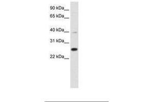 Image no. 1 for anti-YY1 Associated Factor 2 (YAF2) (C-Term) antibody (ABIN6736123) (YAF2 antibody  (C-Term))