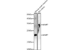 Western blot analysis of extracts of various cell lines, using MMP7 antibody (ABIN7268425 ) at 1:1000 dilution. (MMP7 antibody)