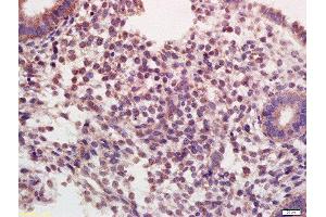 Formalin-fixed and paraffin embedded human endometrium labeled with Rabbit Anti-Oxytocin R Polyclonal Antibody, Unconjugated  at 1:200 followed by conjugation to the secondary antibody and DAB staining (Oxytocin Receptor antibody  (AA 325-388))