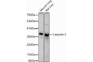 Western blot analysis of extracts of various cell lines, using Caspase-3 antibody (ABIN6134639, ABIN6137978, ABIN6137979 and ABIN6215159) at 1:1000 dilution. (Caspase 3 antibody  (AA 1-100))