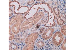 IHC-P analysis of human kidney tissue, with DAB staining. (Osteopontin antibody  (AA 18-314))