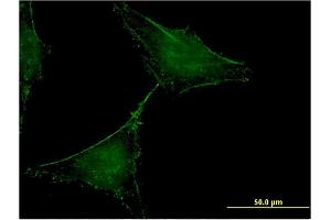 Immunofluorescence of monoclonal antibody to SLAMF7 on HeLa cell. (SLAMF7 antibody  (AA 1-296))