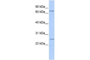 WB Suggested Anti-GALNT14 Antibody Titration:  0. (GALNT14 antibody  (Middle Region))