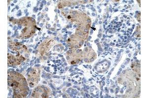 ZNF258 antibody was used for immunohistochemistry at a concentration of 4-8 ug/ml to stain Epithelial cells of renal tubule (arrows) in Human Kidney.