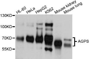 Western blot analysis of extracts of various cells, using AGPS antibody.