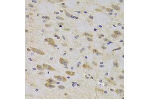 Immunohistochemistry of paraffin-embedded rat brain using RPS27 Antibody (ABIN5974067) at dilution of 1/100 (40x lens).