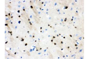 nti- Stathmin 1 Picoband antibody, IHC(P) IHC(P): Rat Brain Tissue (Stathmin 1 antibody  (N-Term))