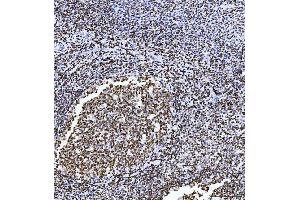 IHC analysis of HMGN2 using anti-HMGN2 antibody (ABIN6719576). (HMGN2 antibody)