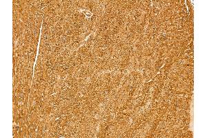 Myoferlin Antibody at 1/100 staining Mouse heart tissue by IHC-P.