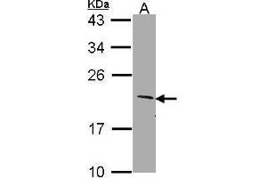 WB Image Sample (30 ug of whole cell lysate) A: Molt-4 , 12% SDS PAGE SERTAD1 antibody antibody diluted at 1:1000 (SERTAD1 antibody  (N-Term))