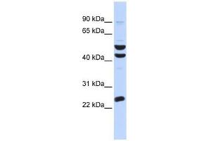 Western Blot showing ZNF200 antibody used at a concentration of 1-2 ug/ml to detect its target protein.