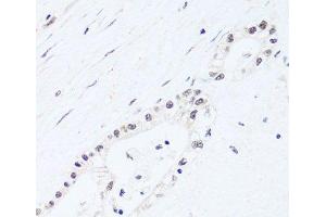 BRIX1 antibody