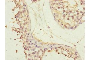 Immunohistochemistry of paraffin-embedded human testis tissue using ABIN7147423 at dilution of 1:100 (CEP72 antibody  (AA 200-460))