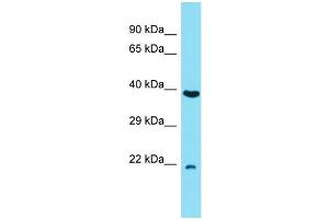 Host: Rabbit Target Name: C7orf50 Sample Type: RPMI-8226 Whole Cell lysates Antibody Dilution: 1. (C7orf50 antibody  (N-Term))