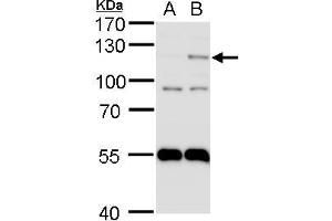 WB Image HIF2 alpha antibody detects HIF2 alpha protein by western blot analysis. (EPAS1 antibody)