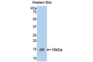 Western Blotting (WB) image for anti-Spectrin alpha Chain, Brain (SPTAN1) (AA 289-408) antibody (ABIN1172700) (SPTAN1 antibody  (AA 289-408))