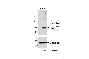 Western blot analysis of lysates from Hela cell line, untreated or treated with paclitaxel, 100nM, 20hrs, using Phospho-P1CA (Thr320) Antibody (uer) or Beta-actin (lower). (PPP1CA antibody  (pThr320))
