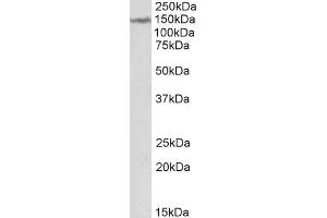Western Blotting (WB) image for anti-Lemur tyrosine Kinase 2 (LMTK2) antibody (ABIN5922076) (LMTK2 antibody)