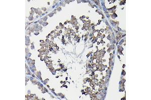 Immunohistochemistry of paraffin-embedded mouse liver using Ferritin Heavy Chain Rabbit pAb (ABIN3021538, ABIN3021539, ABIN3021540 and ABIN6215218) at dilution of 1:100 (40x lens). (FTH1 antibody  (AA 1-183))