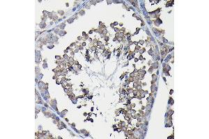 Immunohistochemistry of paraffin-embedded mouse liver using Ferritin Heavy Chain Rabbit pAb (ABIN3021538, ABIN3021539, ABIN3021540 and ABIN6215218) at dilution of 1:100 (40x lens).