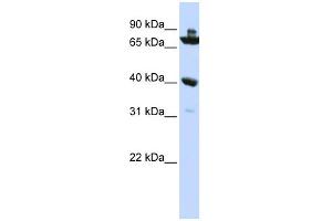 WB Suggested Anti-C7orf31 Antibody Titration: 0. (C7orf31 antibody  (N-Term))