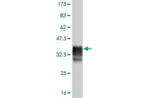 Western Blot detection against Immunogen (35. (DLX5 antibody  (AA 191-279))