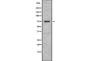 Western blot analysis SphK2 using 293 whole cell lysates