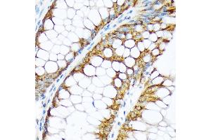 Immunohistochemistry (IHC) image for anti-Ectonucleoside Triphosphate diphosphohydrolase 5 (ENTPD5) antibody (ABIN7266895)