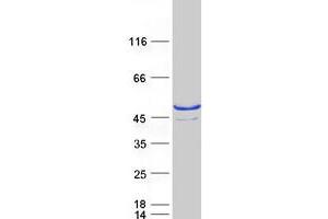Validation with Western Blot (SULT2B1 Protein (Transcript Variant 2) (Myc-DYKDDDDK Tag))