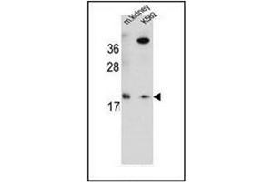 Western blot analysis of RNF185 Antibody  in Mouse kidney tissue and K562 cell line lysates (35ug/lane). (RNF185 antibody  (Middle Region))