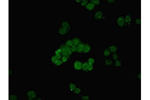 Immunofluorescent analysis of PC-3 cells using ABIN7159152 at dilution of 1:100 and Alexa Fluor 488-congugated AffiniPure Goat Anti-Rabbit IgG(H+L) (MED27 antibody  (AA 67-165))