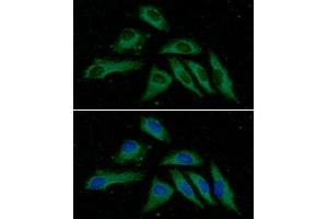 ICC/IF analysis of PPM1F in HeLa cells line, stained with DAPI (Blue) for nucleus staining and monoclonal anti-human PPM1F antibody (1:100) with goat anti-mouse IgG-Alexa fluor 488 conjugate (Green). (PPM1F antibody  (AA 1-454))
