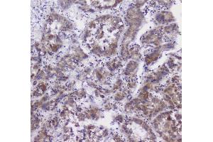 IHC analysis of CFP using anti-CFP antibody (ABIN6719298). (CFP antibody)