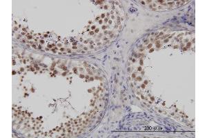 Immunoperoxidase of monoclonal antibody to FUSIP1 on formalin-fixed paraffin-embedded human testis. (SRSF10 antibody  (AA 1-100))
