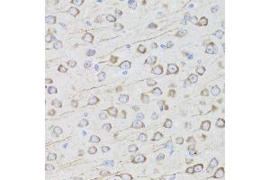 Immunohistochemistry of paraffin-embedded mouse brain using MIP antibody at dilution of 1:100 (x40 lens).